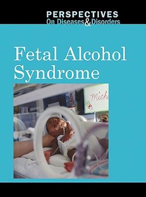 Fetal Alcohol Syndrome