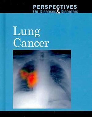 Lung Cancer