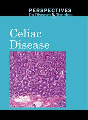 Celiac Disease