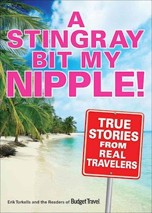 A Stingray Bit My Nipple!