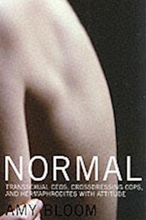 Normal