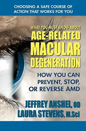 What You Must Know about Age-Related Macular Degeneration