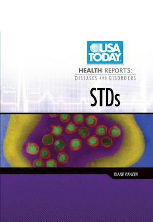 STDs