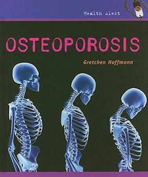 Osteoporosis