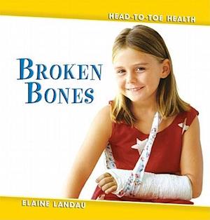 Broken Bones