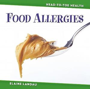 Food Allergies