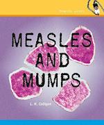 Measles and Mumps