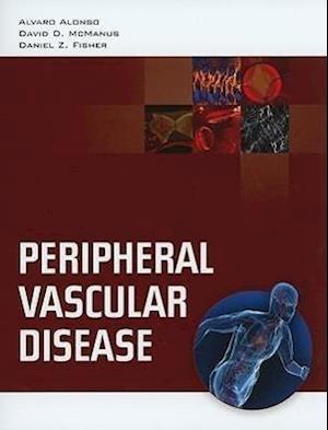 Peripheral Vascular Disease