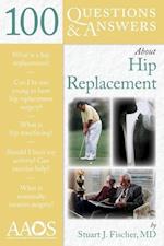 100 Questions  &  Answers About Hip Replacement