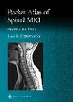 Pocket Atlas of Spinal MRI