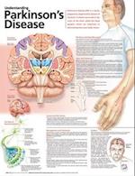 Understanding Parkinson's Disease Anatomical Chart