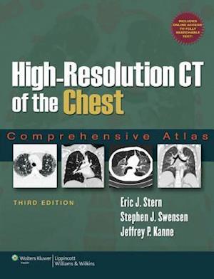 High-Resolution CT of the Chest