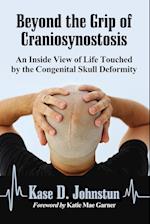 Beyond the Grip of Craniosynostosis