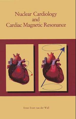 Nuclear Cardiology and Cardiac Magnetic Resonance
