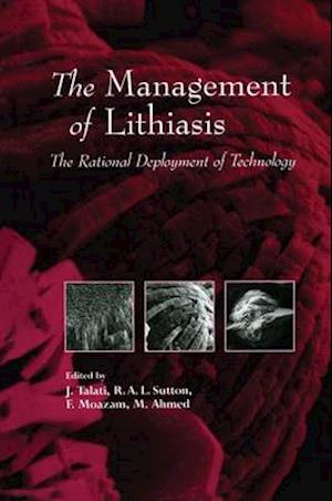 The Management of Lithiasis