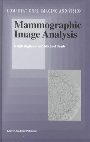 Mammographic Image Analysis