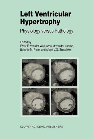 Left Ventricular Hypertrophy