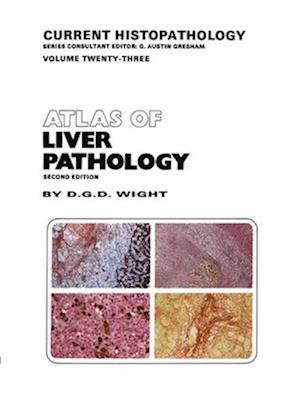 Atlas of Liver Pathology