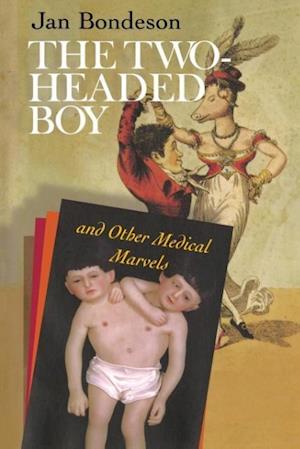 The Two-Headed Boy, and Other Medical Marvels