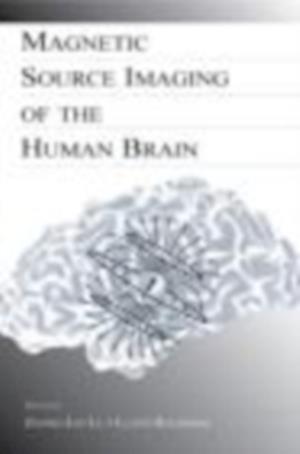 Magnetic Source Imaging of the Human Brain