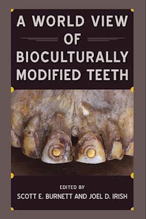 World View of Bioculturally Modified Teeth