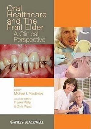 Oral Healthcare and the Frail Elder – A Clinical Perspective