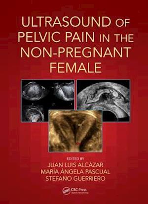 Ultrasound of Pelvic Pain in the Non-Pregnant Patient