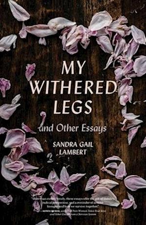 My Withered Legs and Other Essays