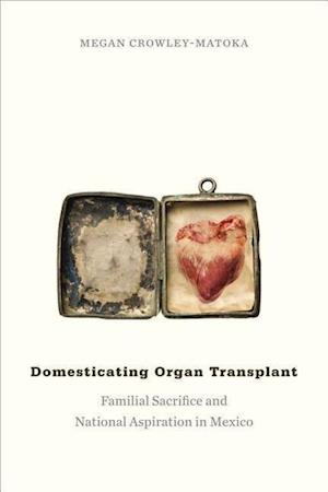 Domesticating Organ Transplant