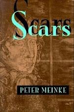 Scars