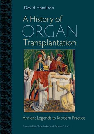 History of Organ Transplantation