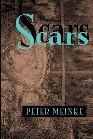 Scars