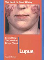 Everything You Need to Know about Lupus