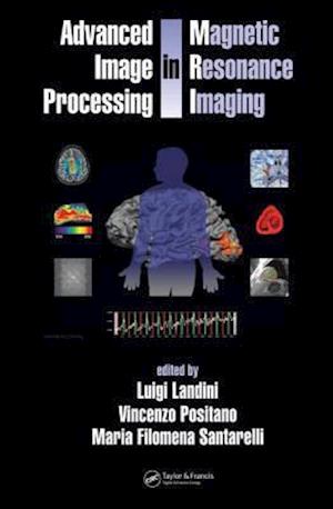 Advanced Image Processing in Magnetic Resonance Imaging