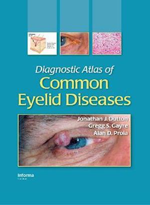 Diagnostic Atlas of Common Eyelid Diseases