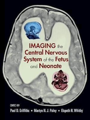 Imaging the Central Nervous System of the Fetus and Neonate