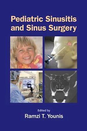 Pediatric Sinusitis and Sinus Surgery