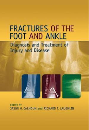 Fractures of the Foot and Ankle