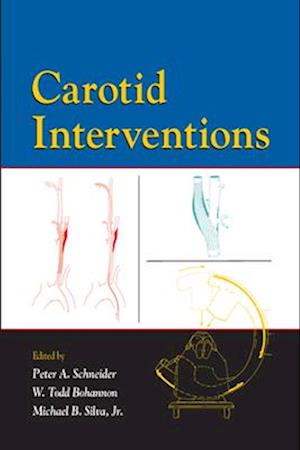 Carotid Interventions