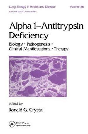 Alpha 1 - Antitrypsin Deficiency