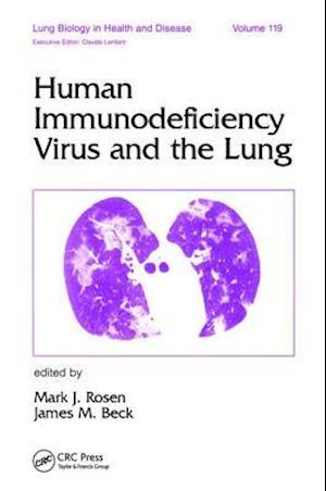 Human Immunodeficiency Virus and the Lung
