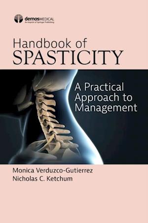 Handbook of Spasticity