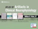 Artifacts in Clinical Neurophysiology