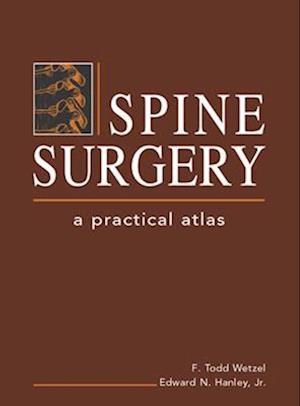 Spine Surgery