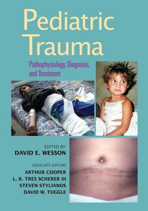 Pediatric Trauma