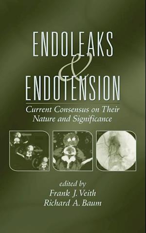 Endoleaks and Endotension