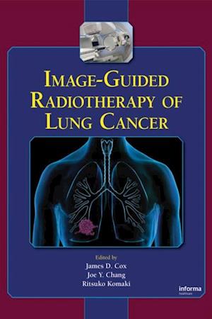 Image-Guided Radiotherapy of Lung Cancer