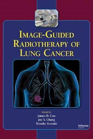 Image-Guided Radiotherapy of Lung Cancer