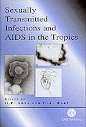 Sexually Transmitted Infections and AIDS in the Tropics