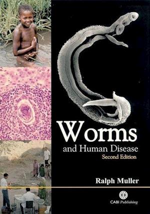 Worms and Human Disease